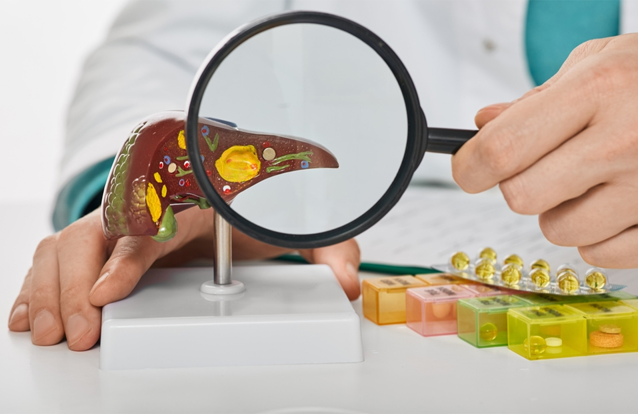 Peradangan Hati (hepatitis)